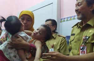 Bayi Kembar Siam Akila-Azila
