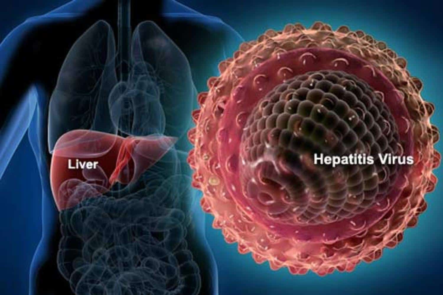 Гепатиты а в с д е