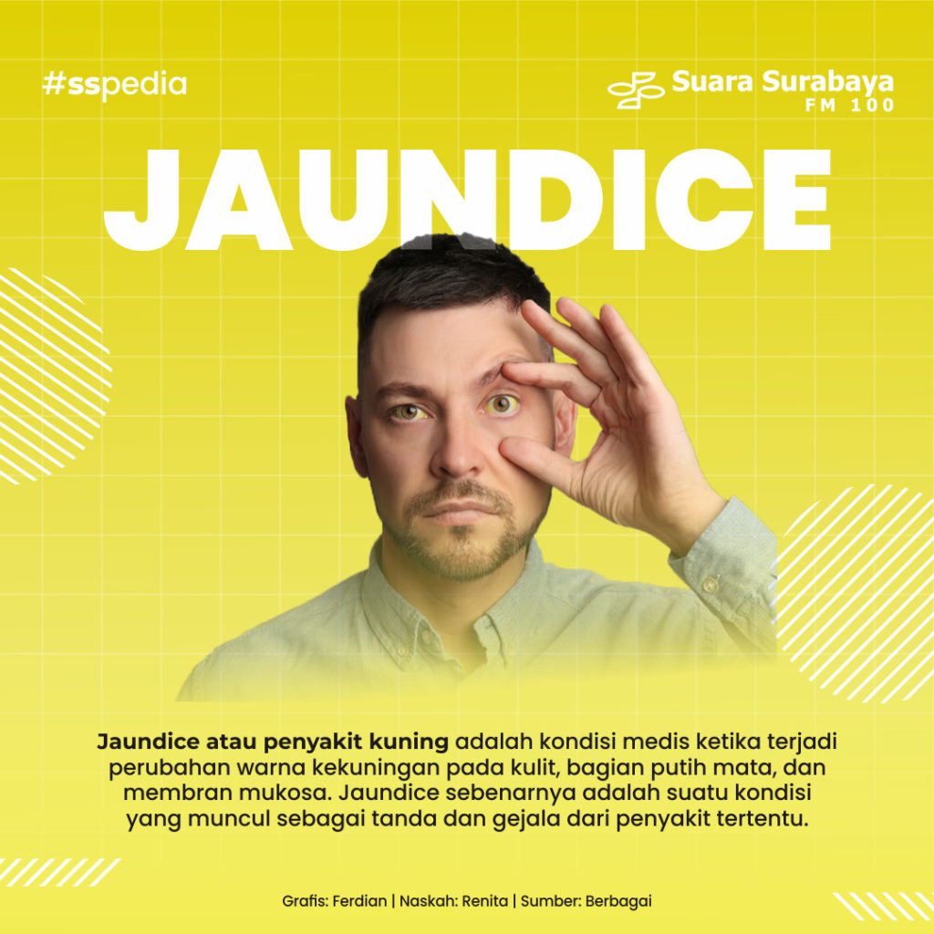 Jaundice