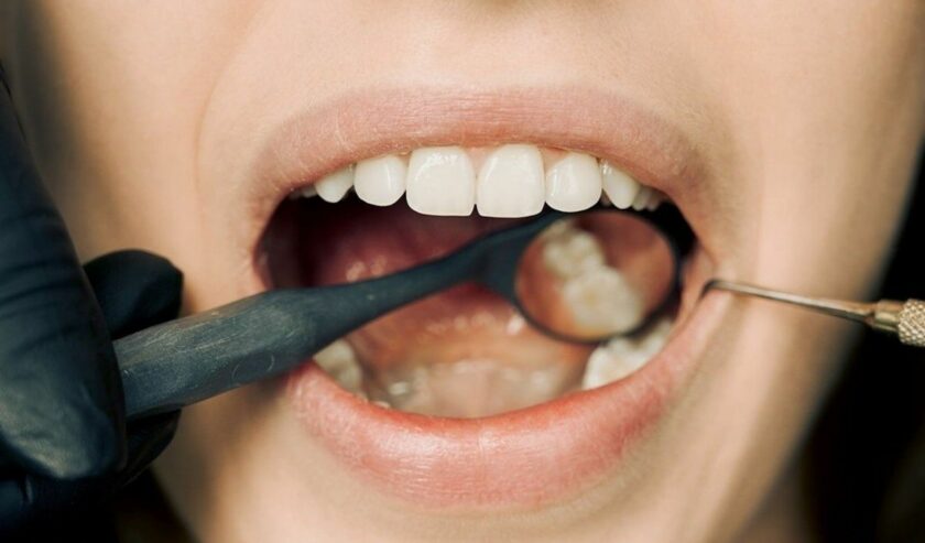 Ilustrasi seseorang menjalani pemeriksaan gigi. Foto: Pexels