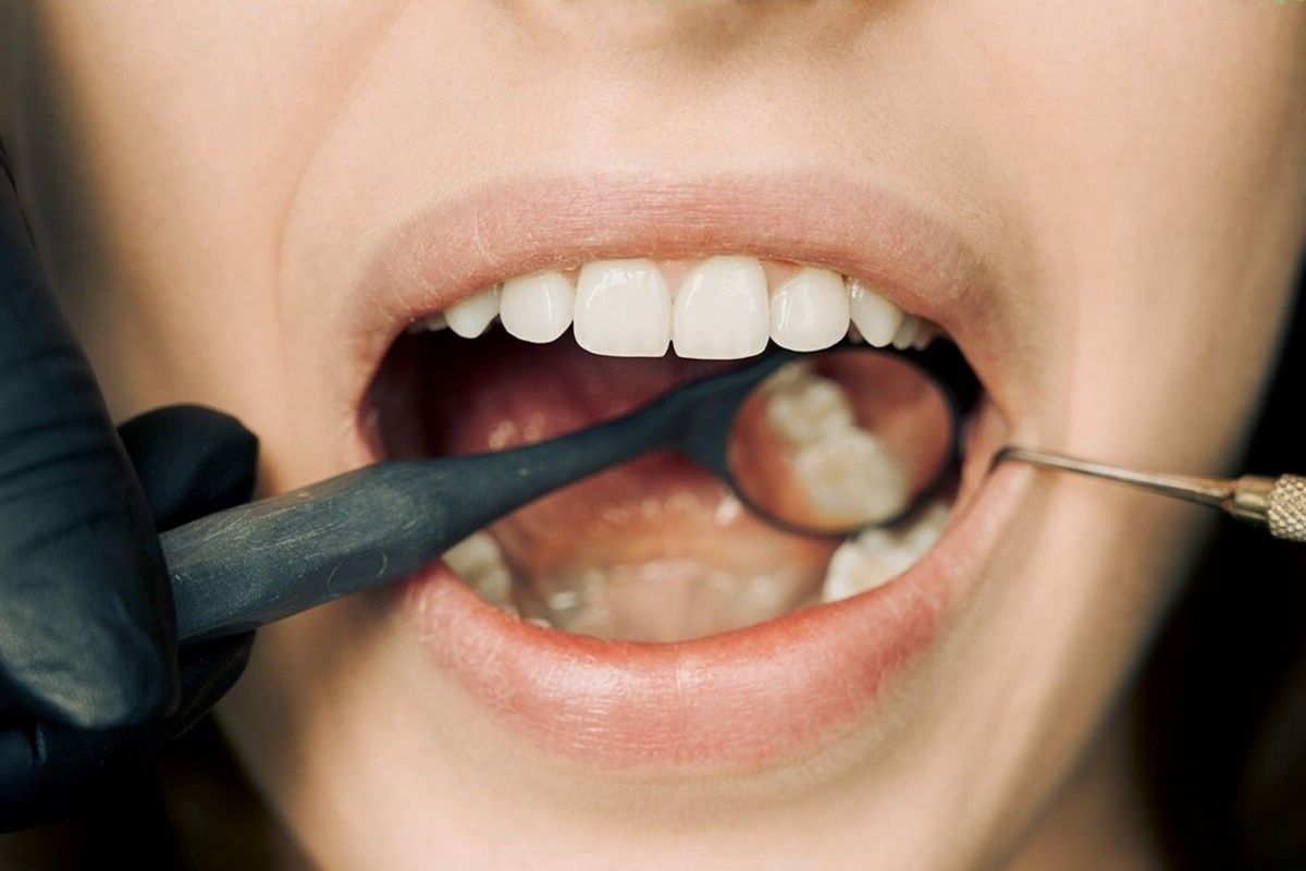 Ilustrasi seseorang menjalani pemeriksaan gigi. Foto: Antara