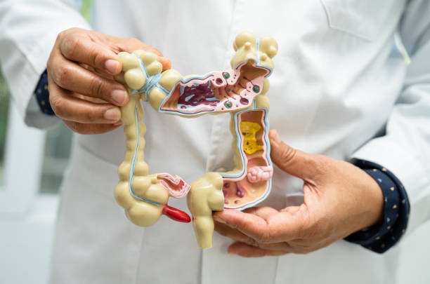 Ilustrasi - Dokter memegang model anatomi untuk studi diagnosis usus buntu dan alat pencernaan. Foto: iStock