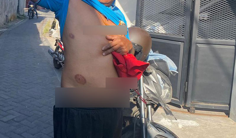 Korban Lida Weden mengungkap kronologi dan ciri-ciri pelaku penembakan OTK di Surabaya