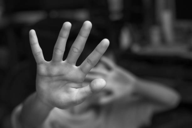 Anak SD Diduga Dibakar Temannya di Situbondo, Polisi Lakukan Panyelidikan